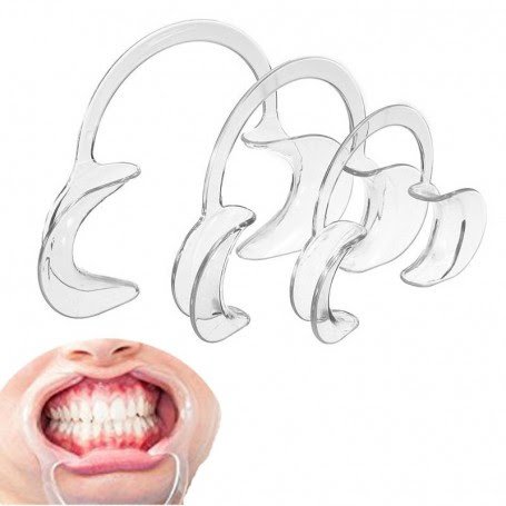 lot de 10 écarteurs buccal lot de 10 écarteurs buccal